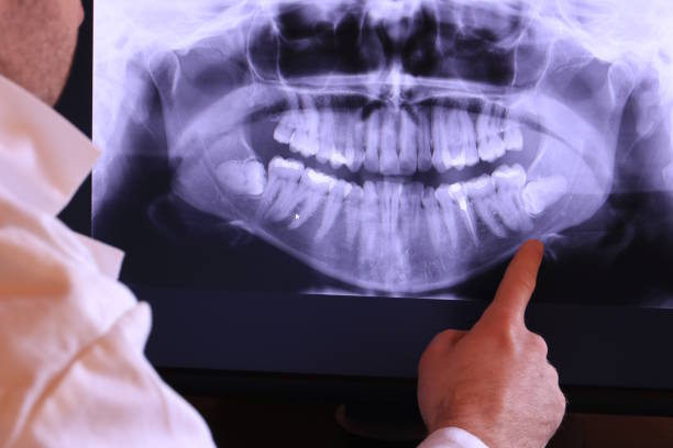 Best Emergency Tooth Extraction in White Mountain Lake, AZ