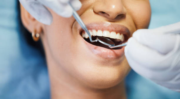 Best Emergency Wisdom Teeth Removal in White Mountain Lake, AZ